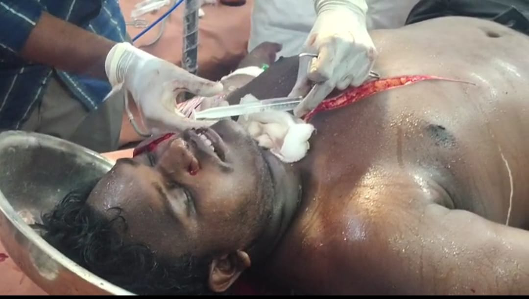 నగరంలో పండ్ల వ్యాపారి పై హత్యాయత్నం