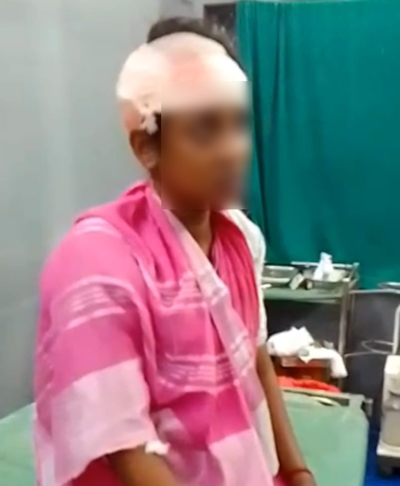 కోడలిపై కత్తితో దాడి చేసిన మామ