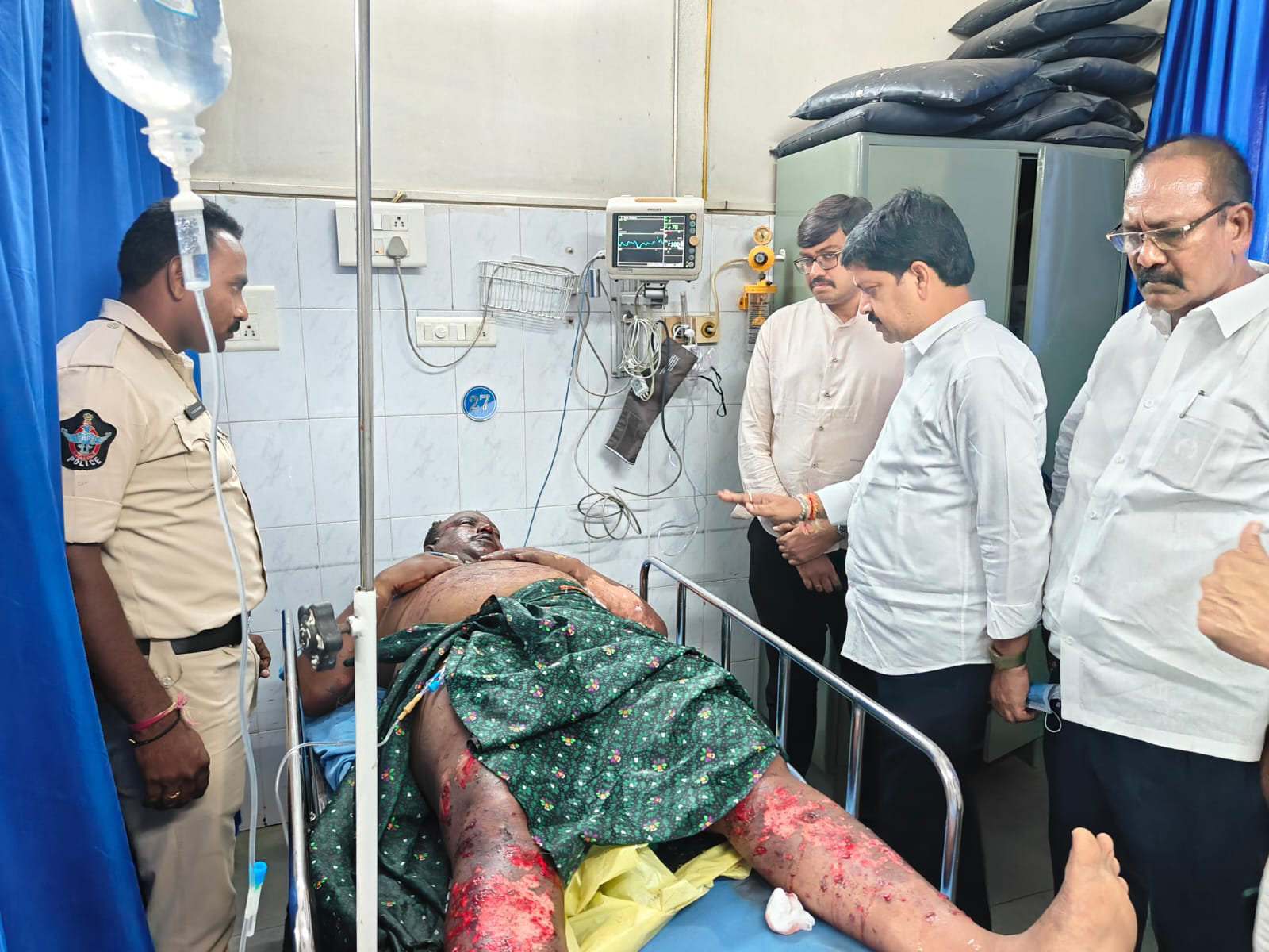 బాణాసంచా పేలి పోలీసు సిబ్బంది గాయపడటం బాధాకరం: మంత్రి కొల్లు రవీంద్ర